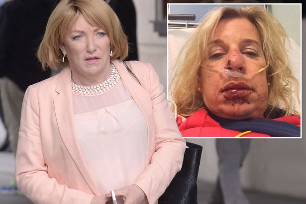 Kellie Maloney on Katie Hopkins