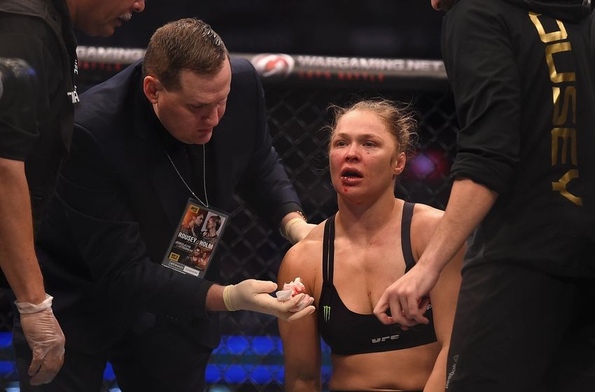 Dana White Ronda Rousey's jaw not broken