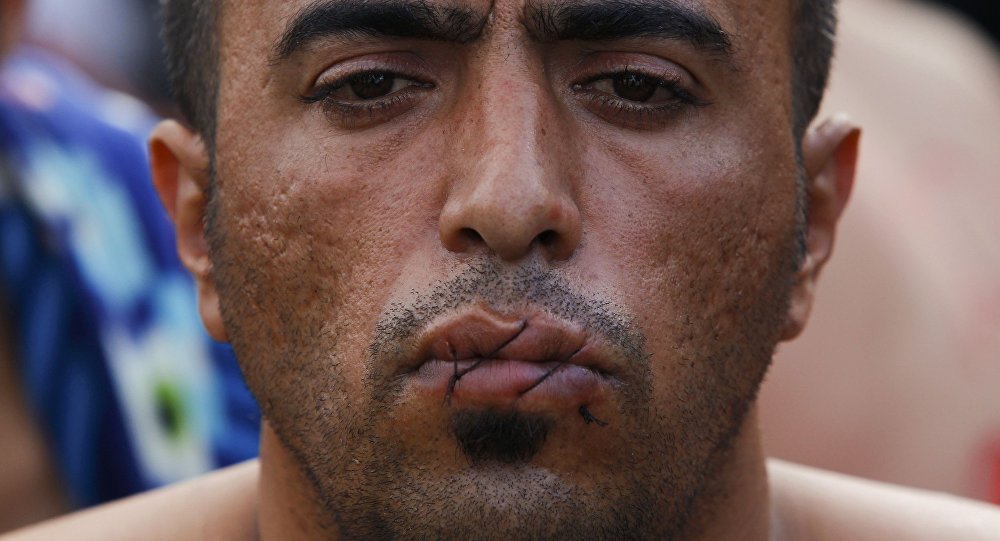 A migrant with his mouth sewn shut in protest sits at the border with Greece near the village of Gevgelija Macedonia