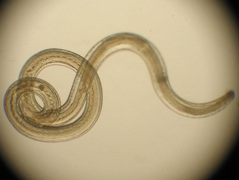 Intestinal worms may help women get pregnant more often