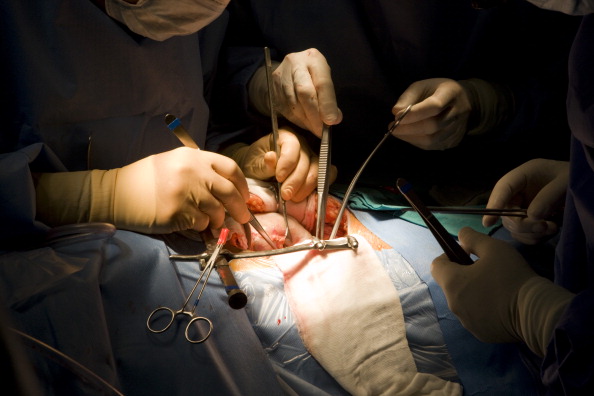 Surgeons performing a kidney transplant