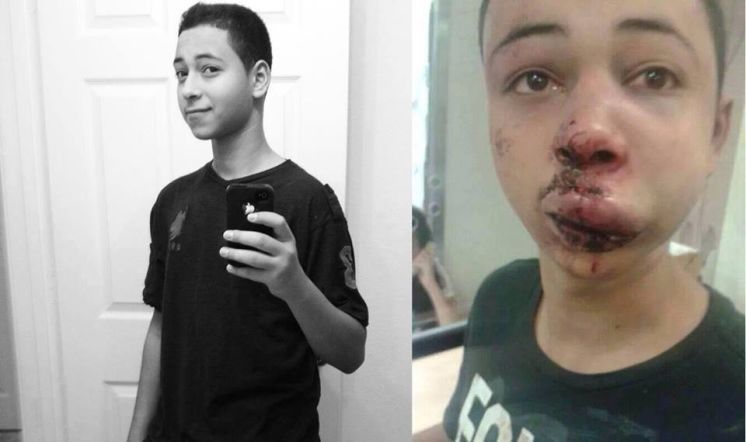 Tariq Khdeir the Tampa teen of Palestinian descent who was being held in Israel after being beaten by Israeli police relatives say