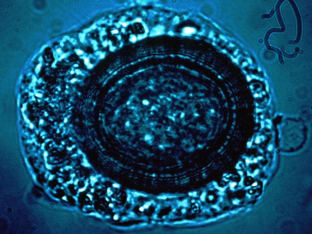 Tapeworm under the microscope