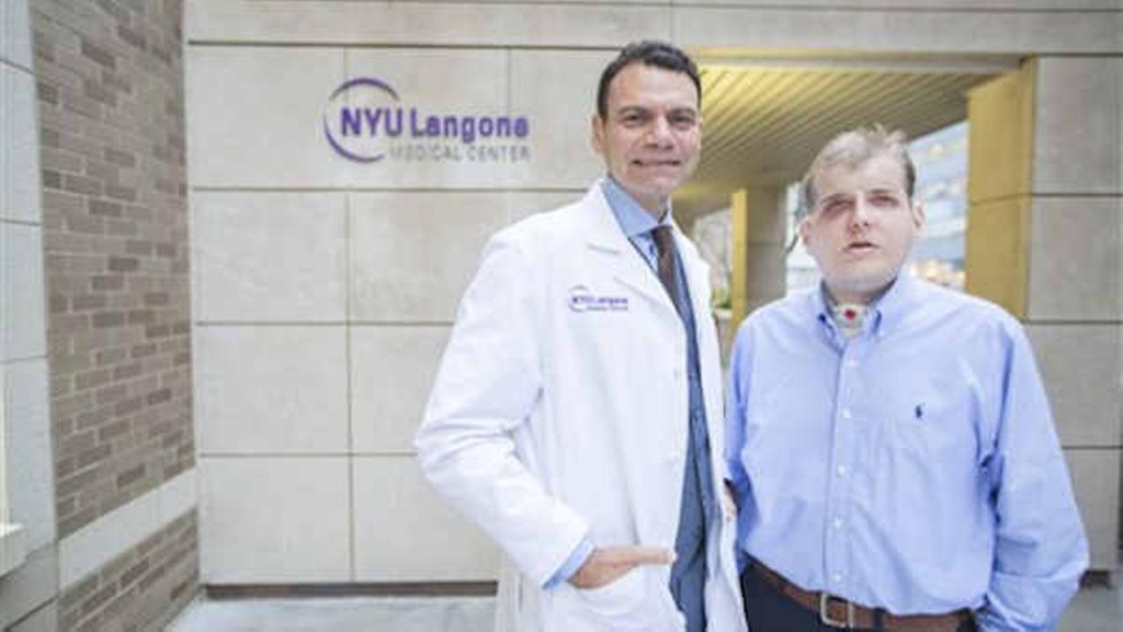 New York plastic surgeon performs 'most extensive' face transplant ever