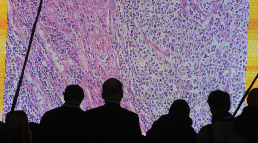 Cancer cells are seen on a large screen connected to a microscope at the Ce Bit computer fair in Hanover