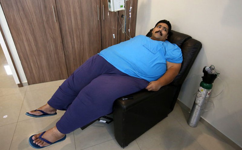 World's most obese man dies after weight-loss surgery