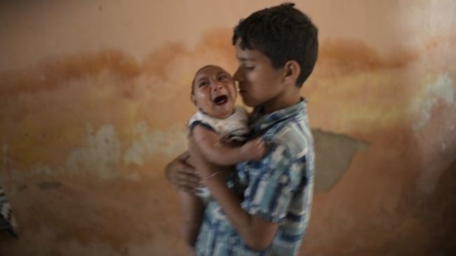 A Brazilian boy holds his two-month-old brother who was born with microcephaly