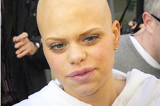 Jade Goody