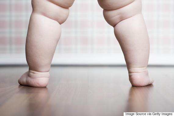 41 million under-fives are overweight, says childhood obesity panel