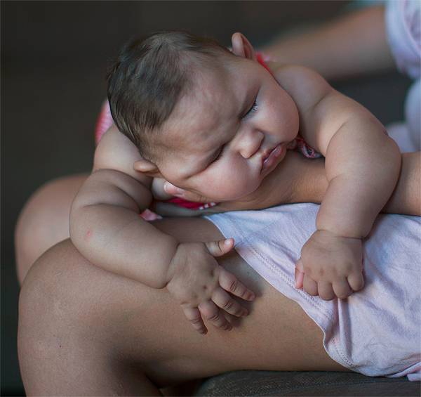 Zika virus Brazil struggles with the birth of deformed babies