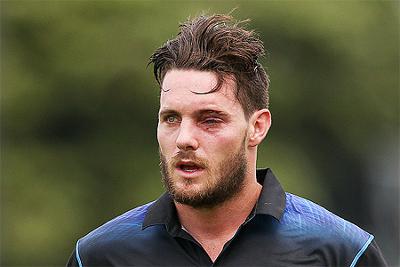 Mitchell Mc Clenaghan leaves the field with an injured eye after being struck by a bouncer