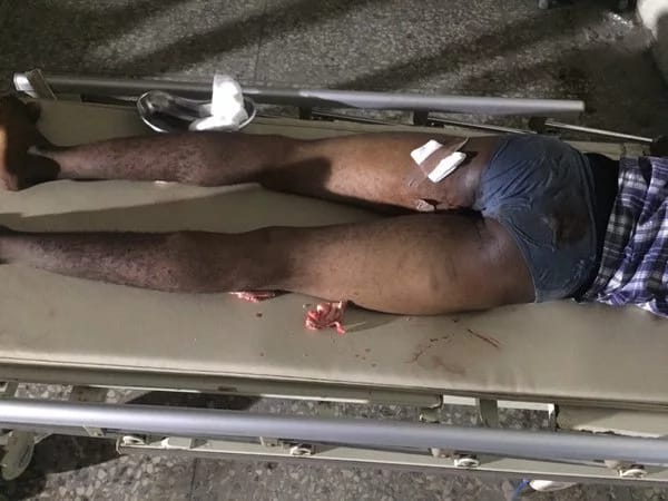 Victims of Bayelsa election violence