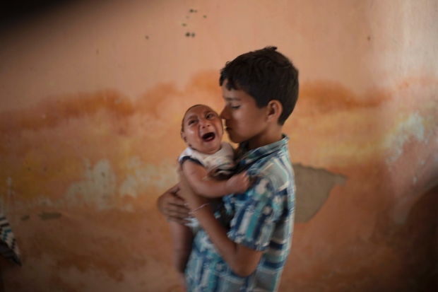 APTOPIX Brazil Zika Birth Defects