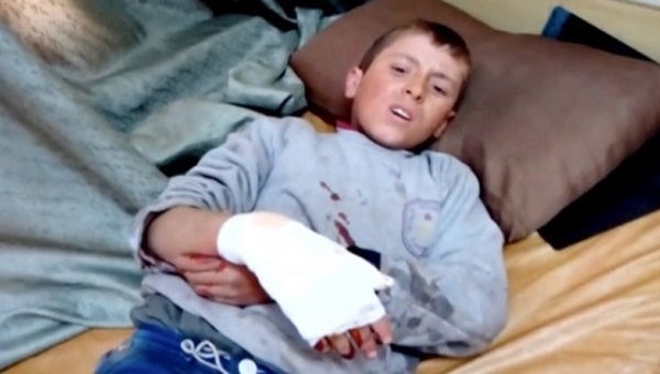 A boy lies on a bed with an injured hand after what is said to be a missile attack on a hospital in Azaz Syria Feb. 15 2016