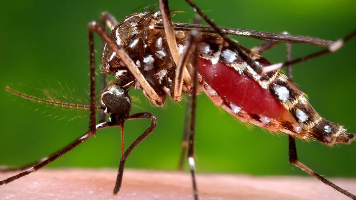 A health official says a first case of sexually transmitted Zika virus has been diagnosed in France