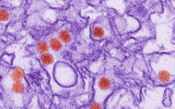 A microscope image of the Zika virus. Courtesy Centers for Disease Control