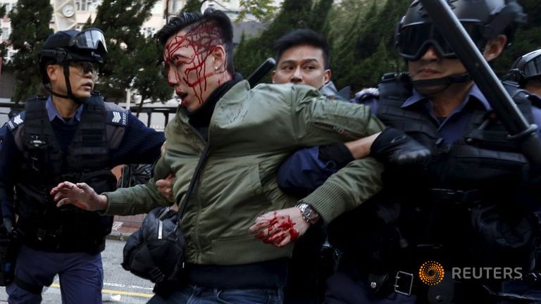 An unidentified injured man is escorted by riot police at Mongkok in Hong Kong China