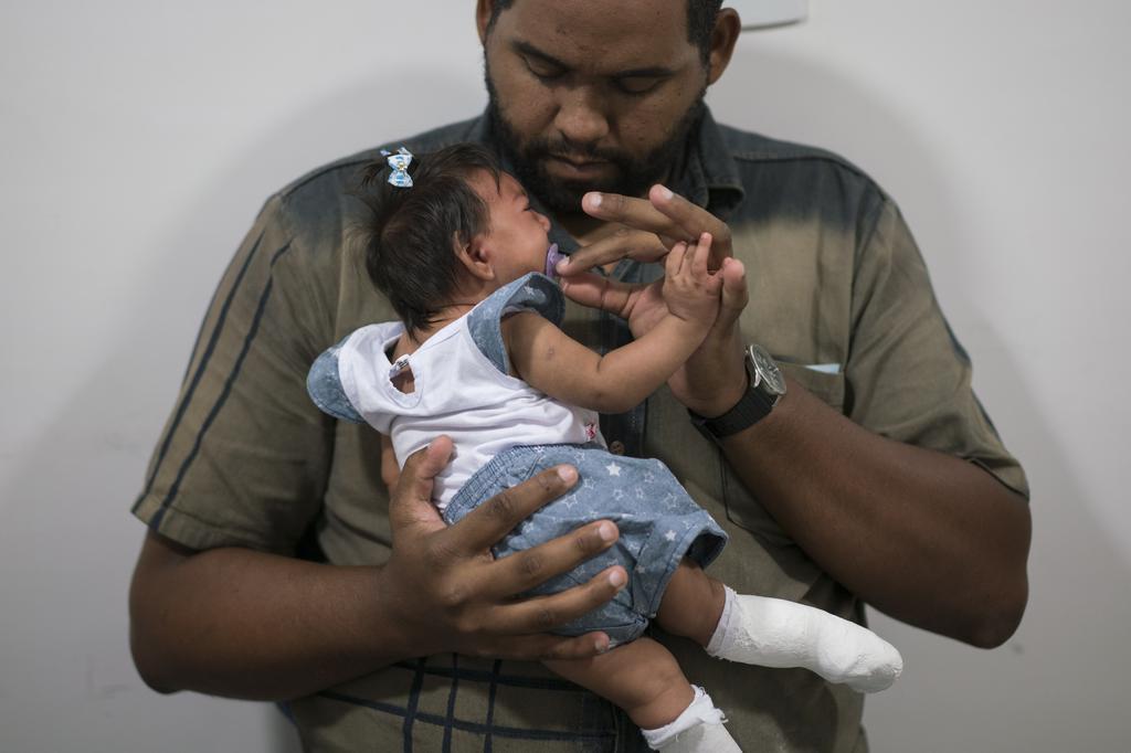 Laurinaldo Alves adjusts the pacifier of his daughter Luana Vitoria who suffers from microcephaly during a physical stimulation session at the Altino Ventura foundation a treatment center that provides free health care in Recife Pernambuco state Bra