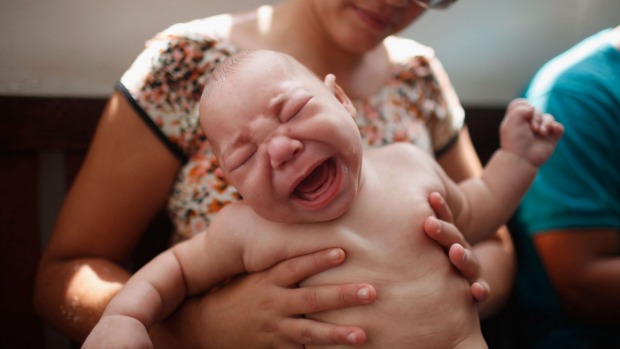 David Henrique Ferreira aged 5 months was born with microcephaly