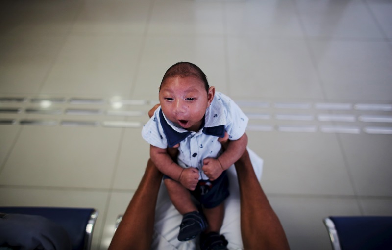 Two-month-old Gustavo Henrique from Brazil was born with microcephaly