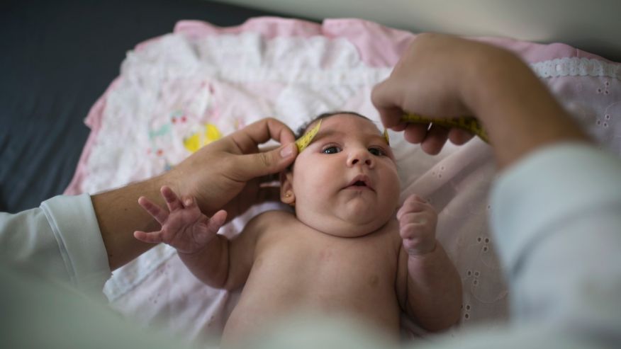 Luiza has her head measured by a neurologist at the Mestre Vitalino Hospital in Caruaru Pernambuco state Brazil. Luiza was born in October with a head that was just 11.4 inches in diameter more than an inch