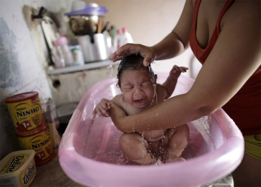 Doctors puzzle over severity of defects in some Brazilian babies