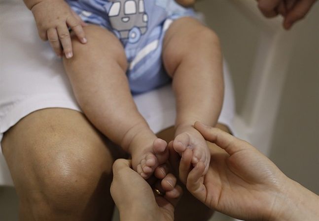 A health worker gives foot massage to 3-month-old Pedro Henrique in a hospital in Joao Pessoa Brazil Wednesday Feb. 24 2016 during an examination that's part of a study to determine if the Zika virus is causing babies to be born with a birth defect