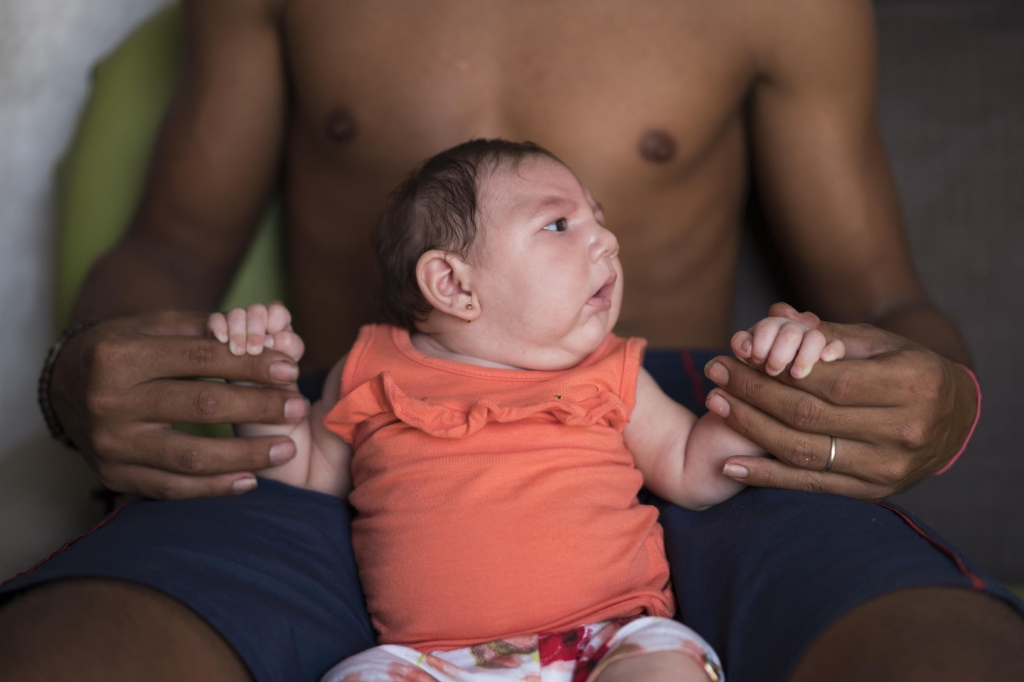 2015 Dejailson Arruda holds his daughter Luiza at their house in Santa Cruz do Capibaribe Pernambuco state Brazil. Luiza was born with microcephaly and authorities think it was caused by her mother's Zika virus infectio