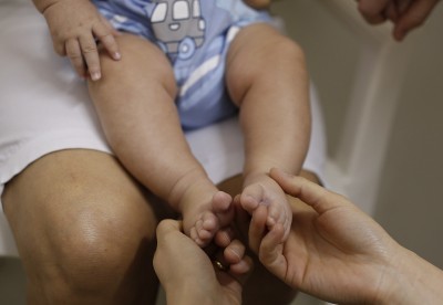 Research on link between Zika and birth defects expected by May