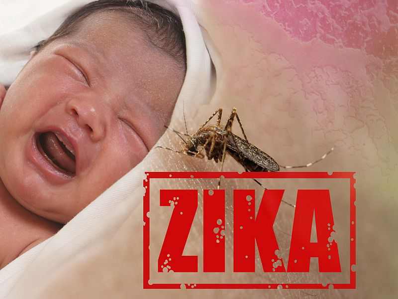 Researchers Detect Zika Virus in Fetal Brain, Big Clue in Link to Microcephaly