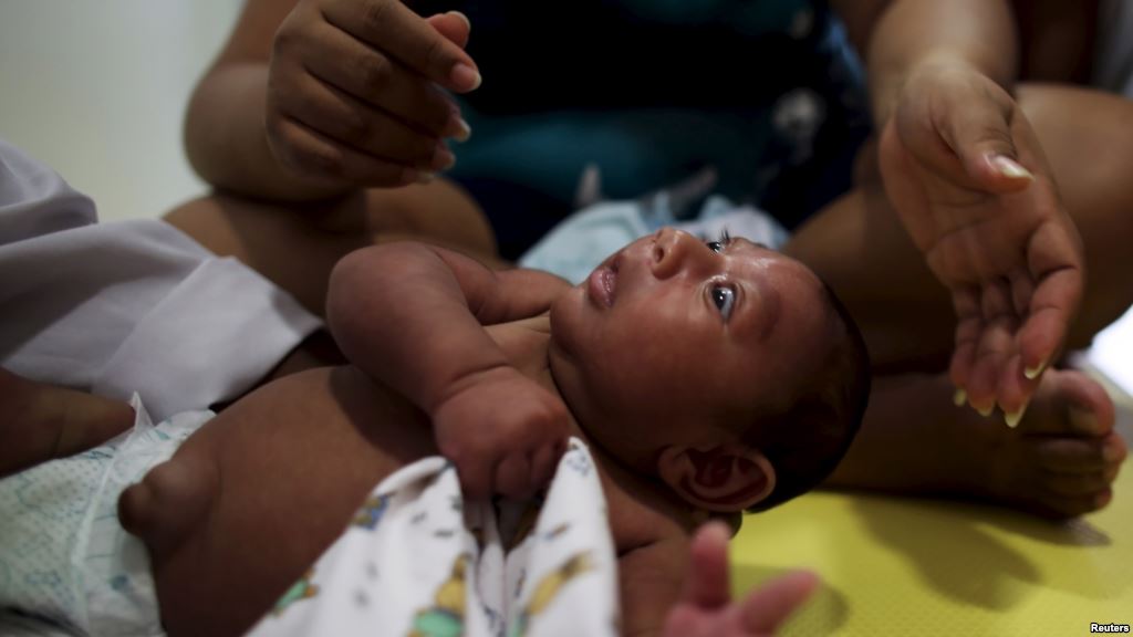 Gustavo Henrique who is 2-months old and born with microcephaly reacts to stimulus during an evaluation session with a physiotherapist at the Altino Ventura rehabilitation center in Recife Brazil Feb. 11 2016