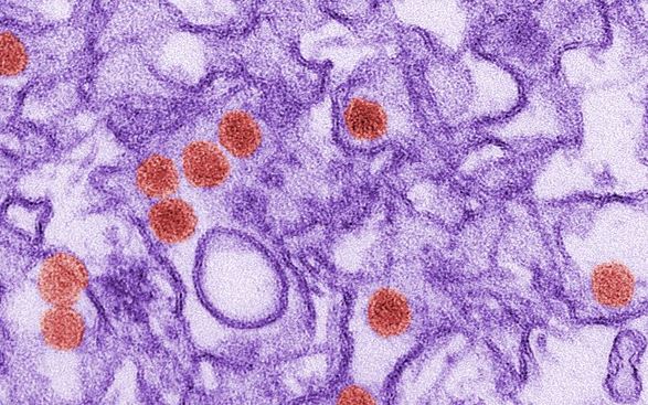 First case of Zika virus transmitted through sexual contact confirmed