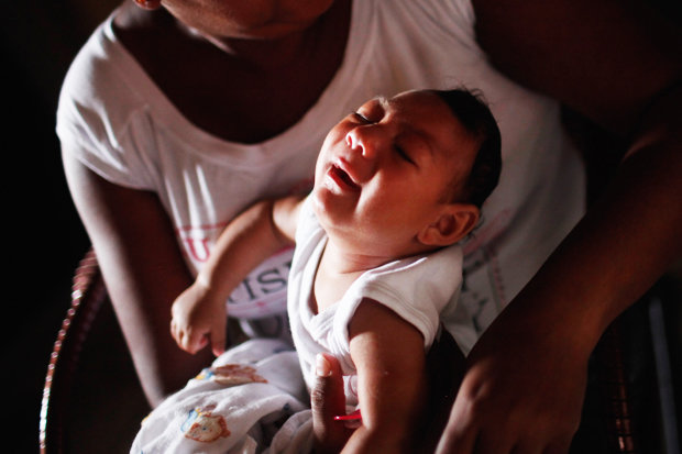 Newborn with Zika