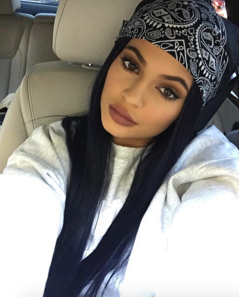 Did Kylie Jenner Get Lip Injections