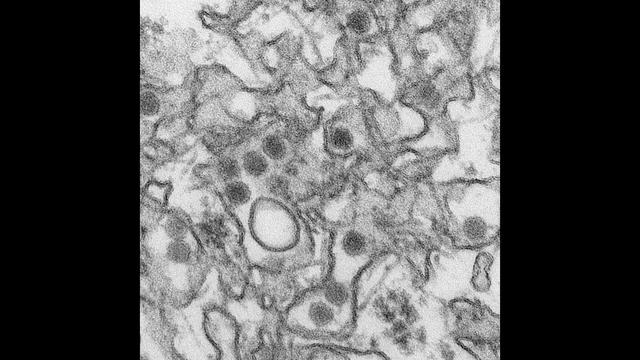 Breakthrough Study Shows Strong Link Between Zika Virus, Severe Birth Defects