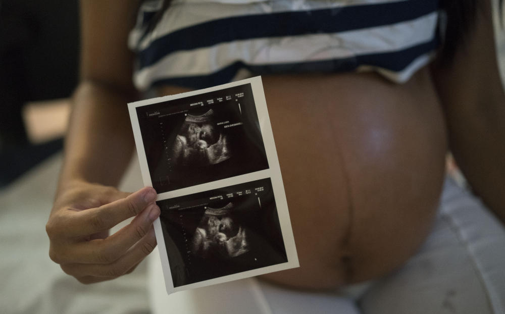 Study Finds Multiple Problems In Fetuses Exposed To Zika Virus
by Rob Stein