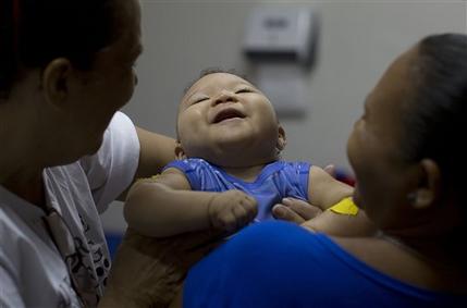 Caio Julio Vasconcelos who was born with microcephaly undergoes physical therapy at the Institute for the Blind in Joao Pessoa Brazil. Researchers say the Zika virus may be linked to a wider variety of “grave outcomes