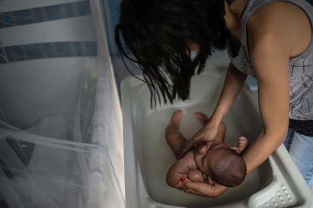 A woman bathes her son suffering from microcephaly in Salvador Brazil