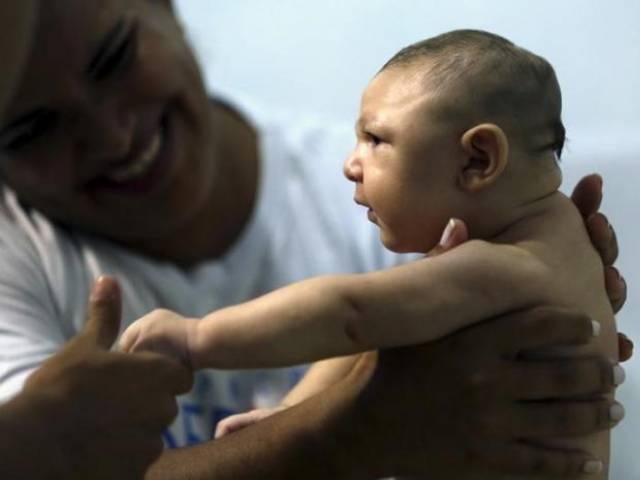 Therapist Rozely Fontoura holds Juan Pedro who has microcephaly in Recife Brazil