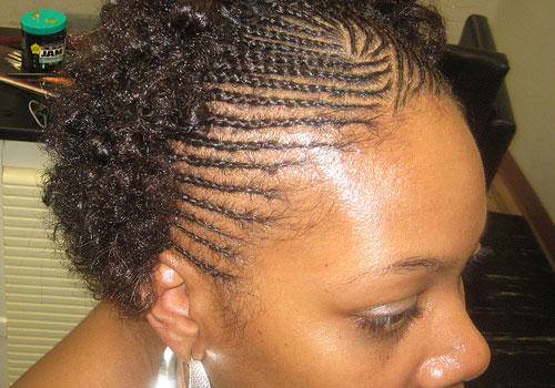 A Third of African American Women Suffer Alopecia- Scalp Pulling Hairstyles Blamed