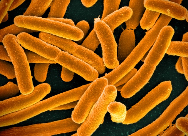 E. coli from Wikipedia commons