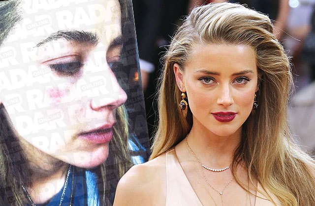 Amber Heard claims Johnny Depp assaulted her: report