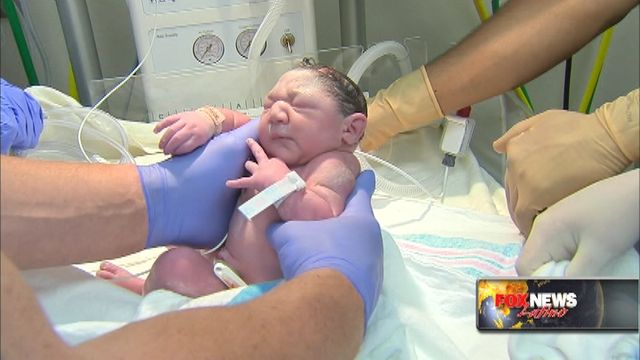 Baby born in NJ with defect related to Zika virus