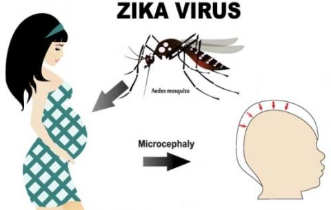 New Jersey infant second baby born in US suspected of having Zika-related microcephaly