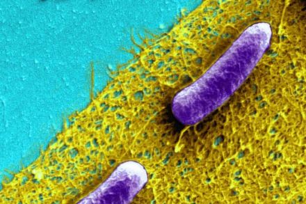 First Antibiotic-resistant Superbug Found in US