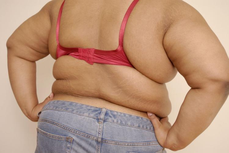 40% of U.S. Women Are Now Obese