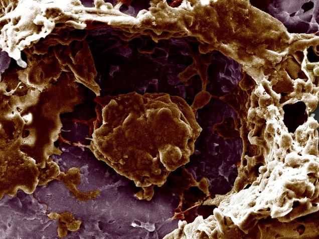 A scanning electron micrograph of cancer cells growing in pores of a 3D scaffold