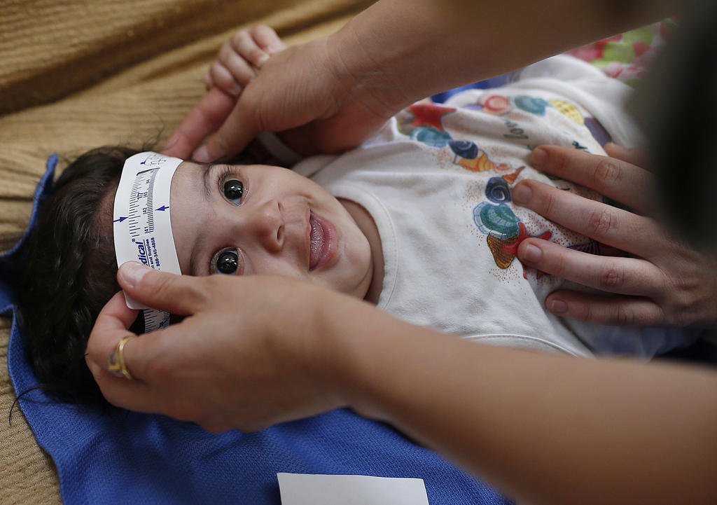 3-month-old Esther Kamilly has her head measured by Brazilian and U.S. health workers from the United States Centers for Disease Control and Prevention at her home in Joao Pessoa Brazil as part