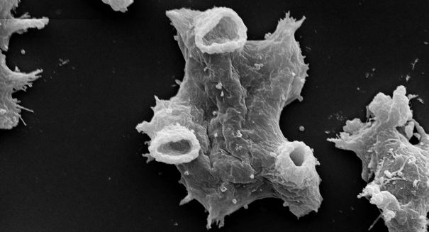 Brain-eating amoeba in Charlotte freshwater claims Ohio teenager