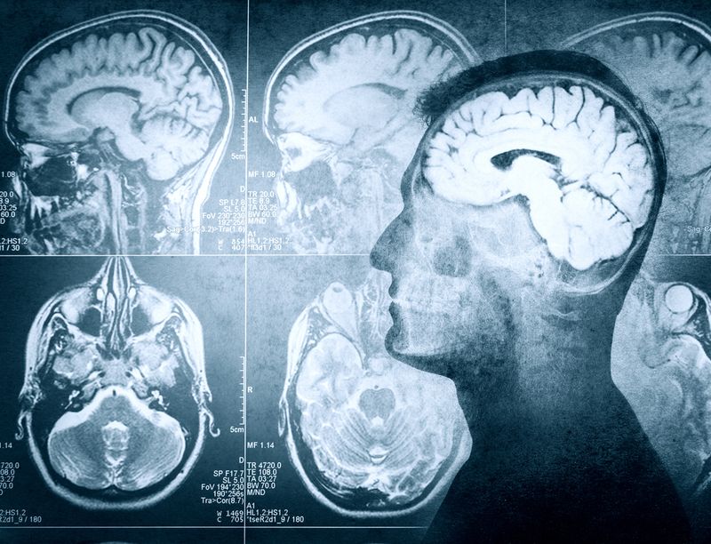 Conceptual image of a man from side profile showing brain and brain activity